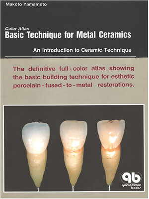 cover image of Color Atlas Basic Technique for Metal Ceramics